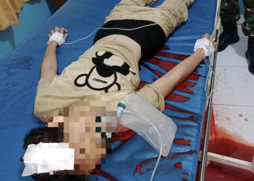 Pelajar di Kampar Tewas Tertembak Senapan Angin