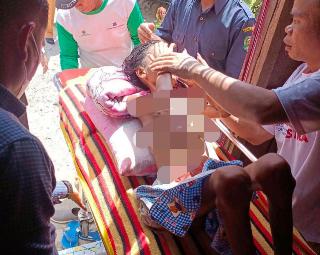 Aipda Leonar Gendong Tirta Berobat ke RS Setelah Tiga Bulan Terbaring Lemah & Dirawat Seadanya