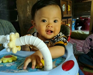 Seorang Bayi Berjuang Hidup Tanpa Anus, Butuh Uluran Tangan Para Dermawan 