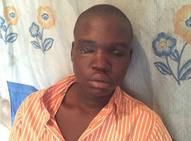 Ngeri, Mata Hussain Dicongkel untuk Ritual Perdukunan