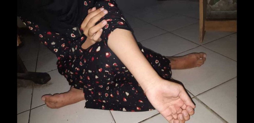 Diduga Depresi, Ibu Dua Anak di Pekanbaru Hampir Lukai Diri dengan Pisau Cutter