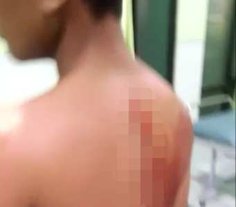 Pesan Berantai Korban Begal di Belakang MTQ Pekanbaru Hoax atau Fakta?, Ini kata Polisi 